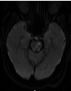 Figure 1A