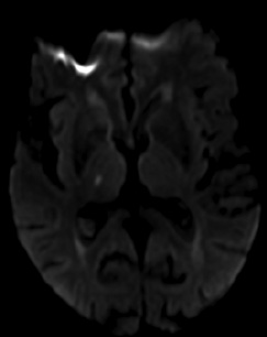 Figure 1B