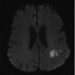Figure 2A