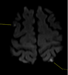 Figure 2B