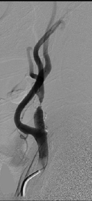 Figure 3A