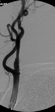 Figure 3B