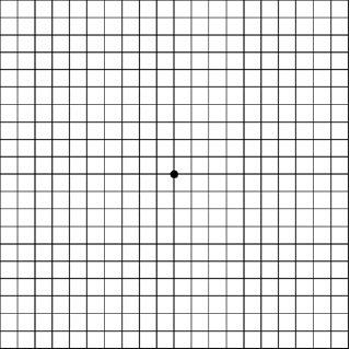 Amsler Grid