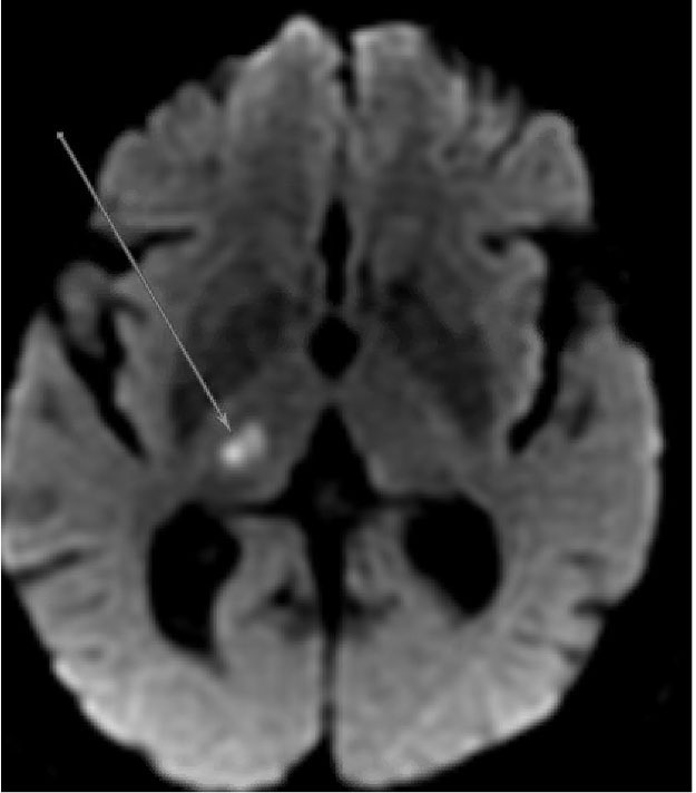 Figure 1 Image A