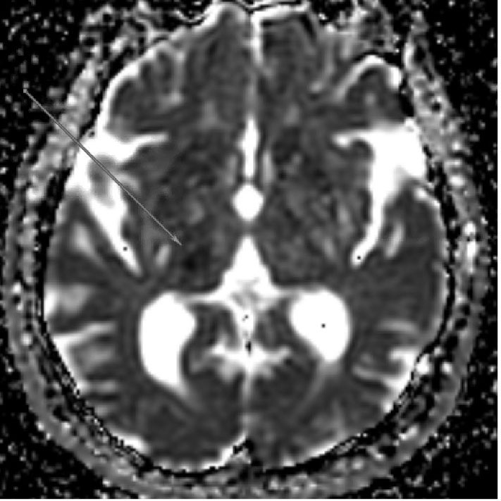 Figure 1 Image B