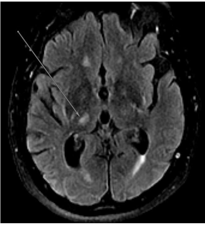 Figure 1 Image C