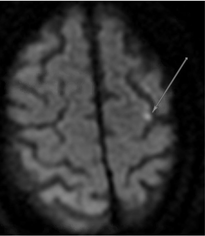 Figure 2 Image A