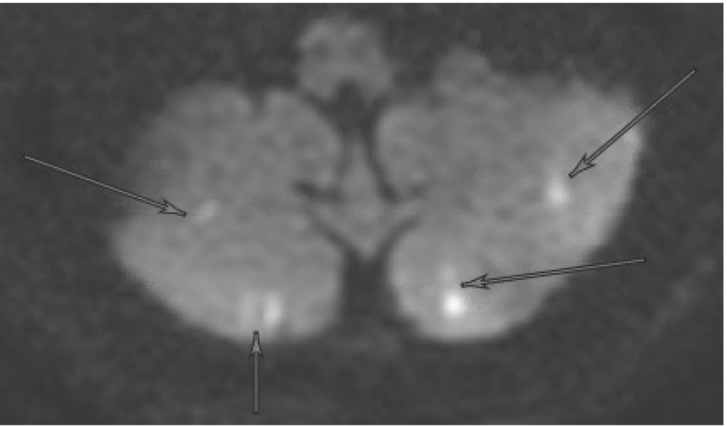 Figure 2 Image B