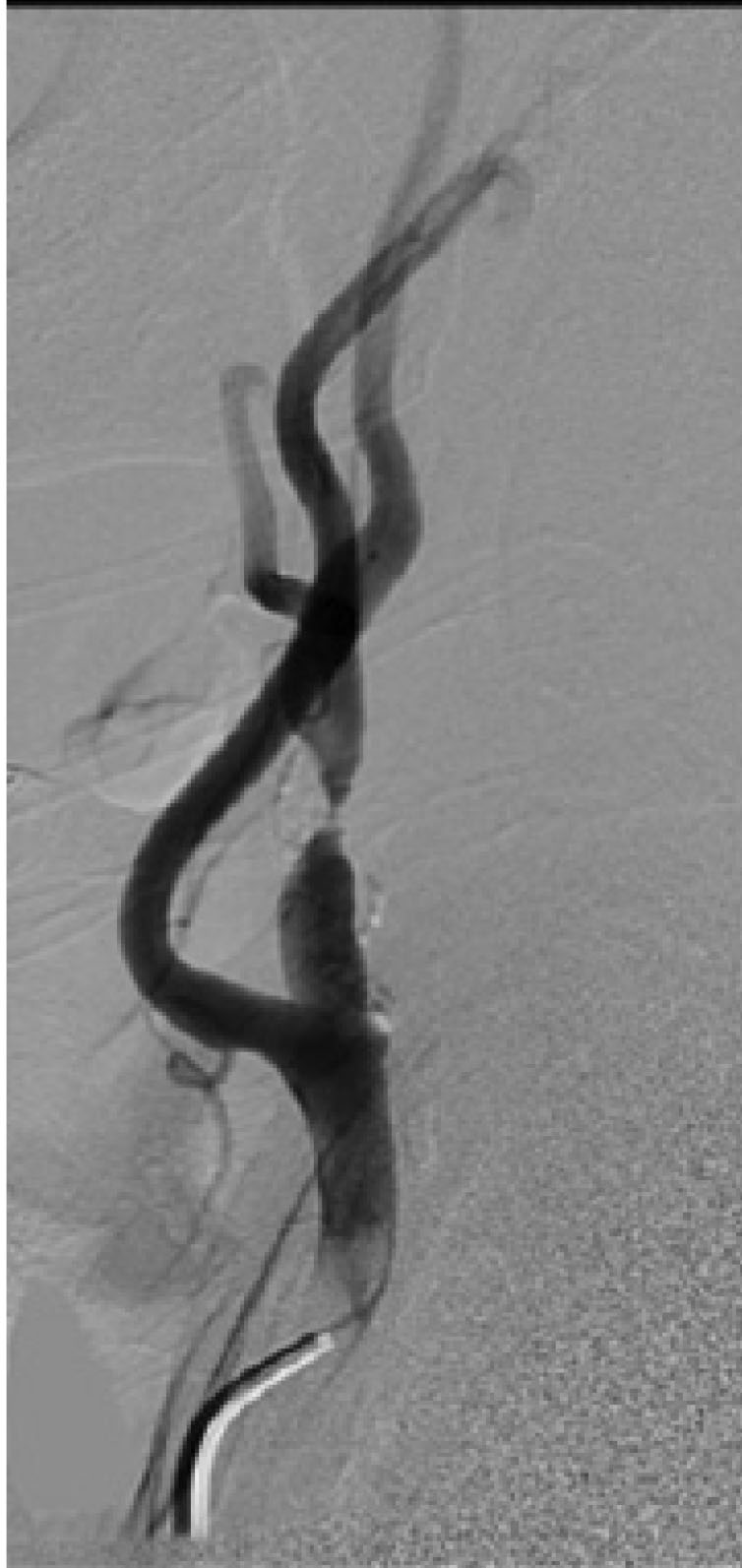 Figure 3 Image A