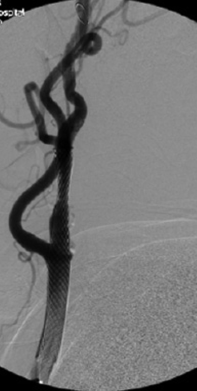 Figure 3 Image B