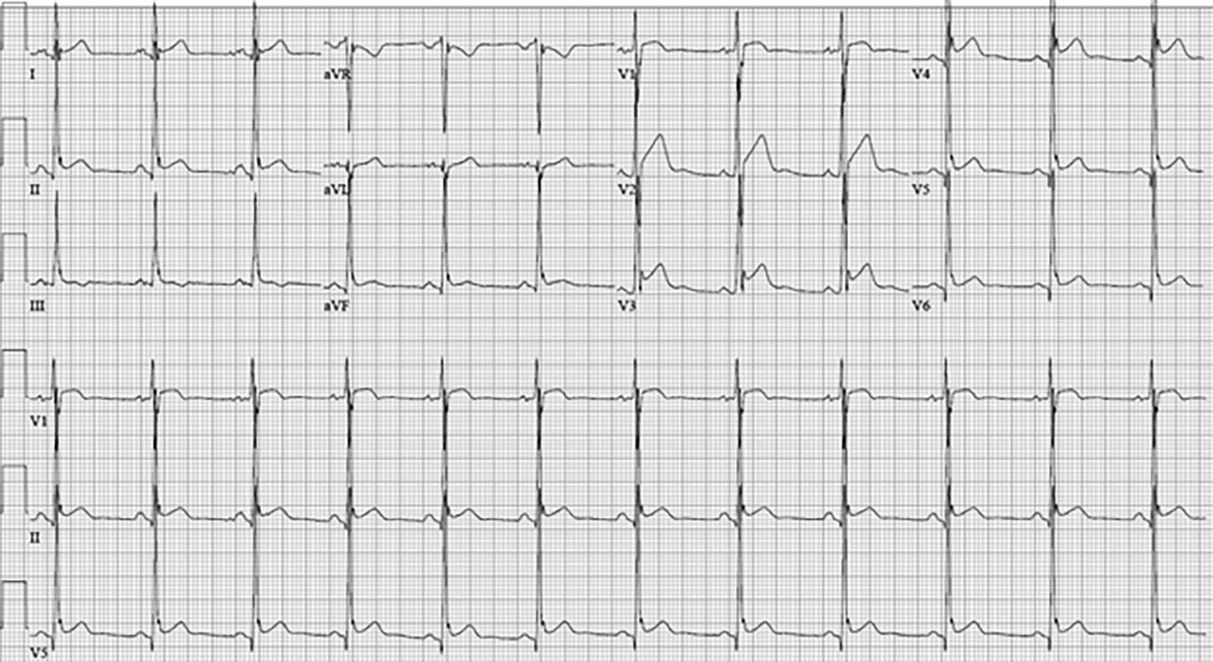 PCR 040122_Figure 1.jpg