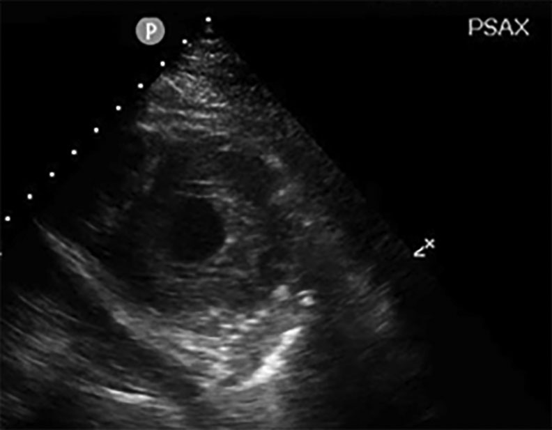 PCR 040122_Figure 4.jpg