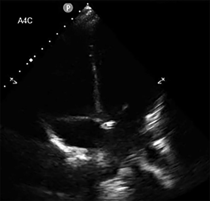 PCR 040122_Figure 5.jpg