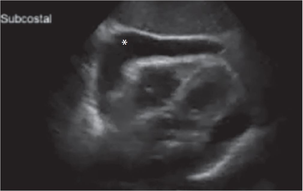 PCR 040122_Figure 6.JPG