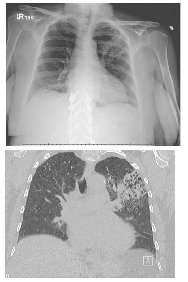 PCR 050122_Figure 1.jpg
