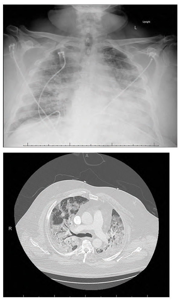PCR 050122_Figure 2.jpg