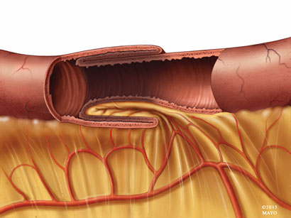 Figure 1a
