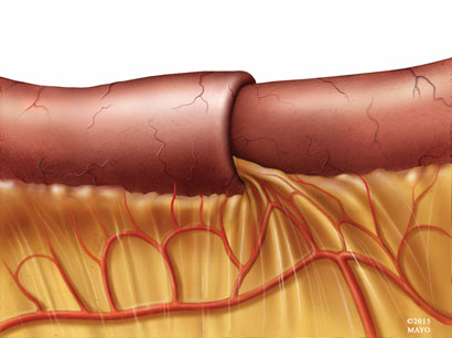 Figure 1b
