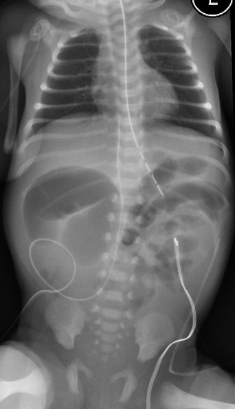 Figure 5a