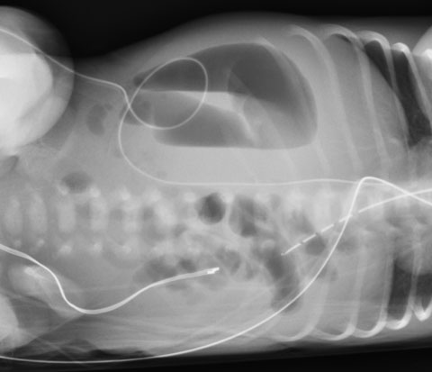 Figure 5b
