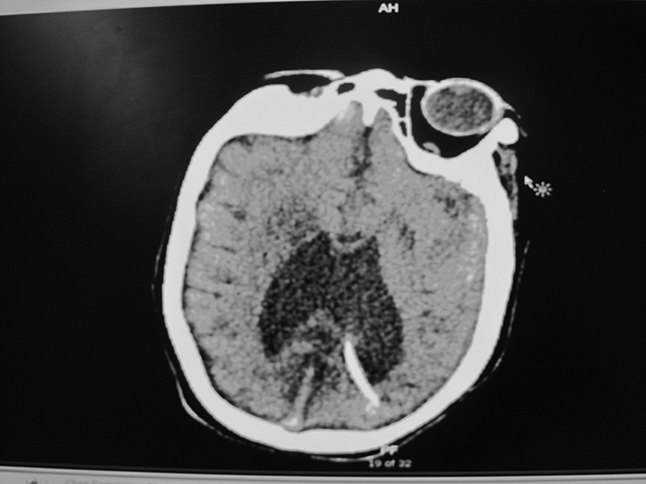 Figure 1B