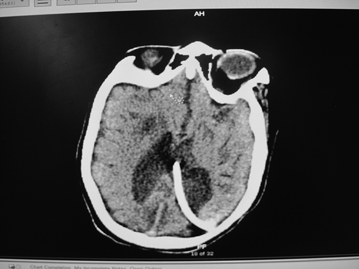 Figure 1C