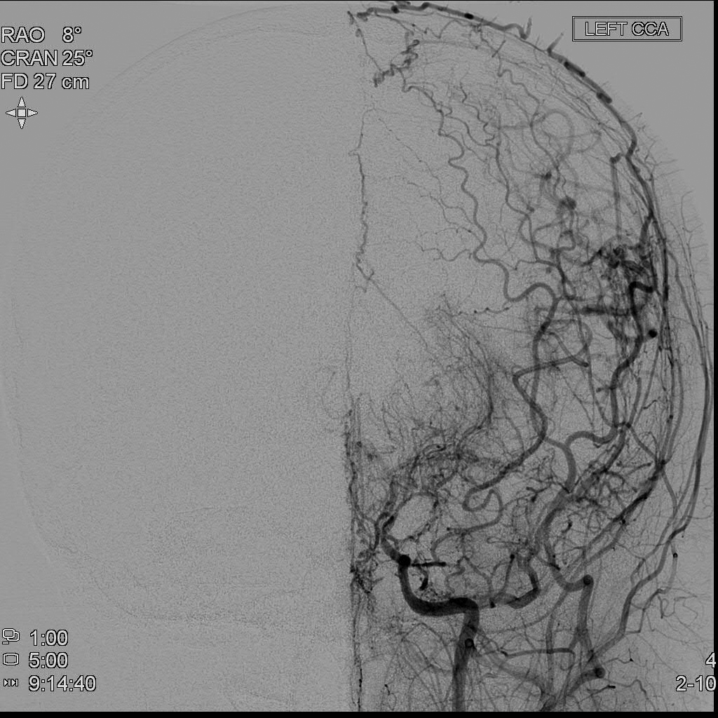 Figure 1b