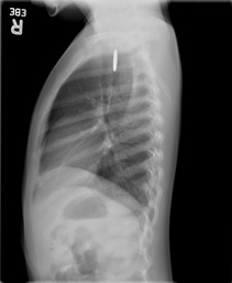 Figure 1B