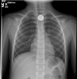 Figure 1A