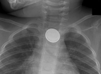 Figure 2A