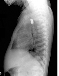 Figure 2B