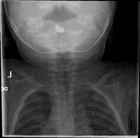 Figure 4B