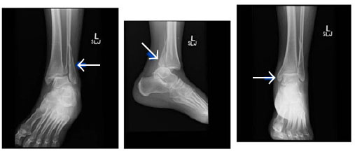 Figure 10