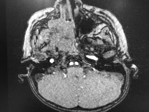 Figure 2 b