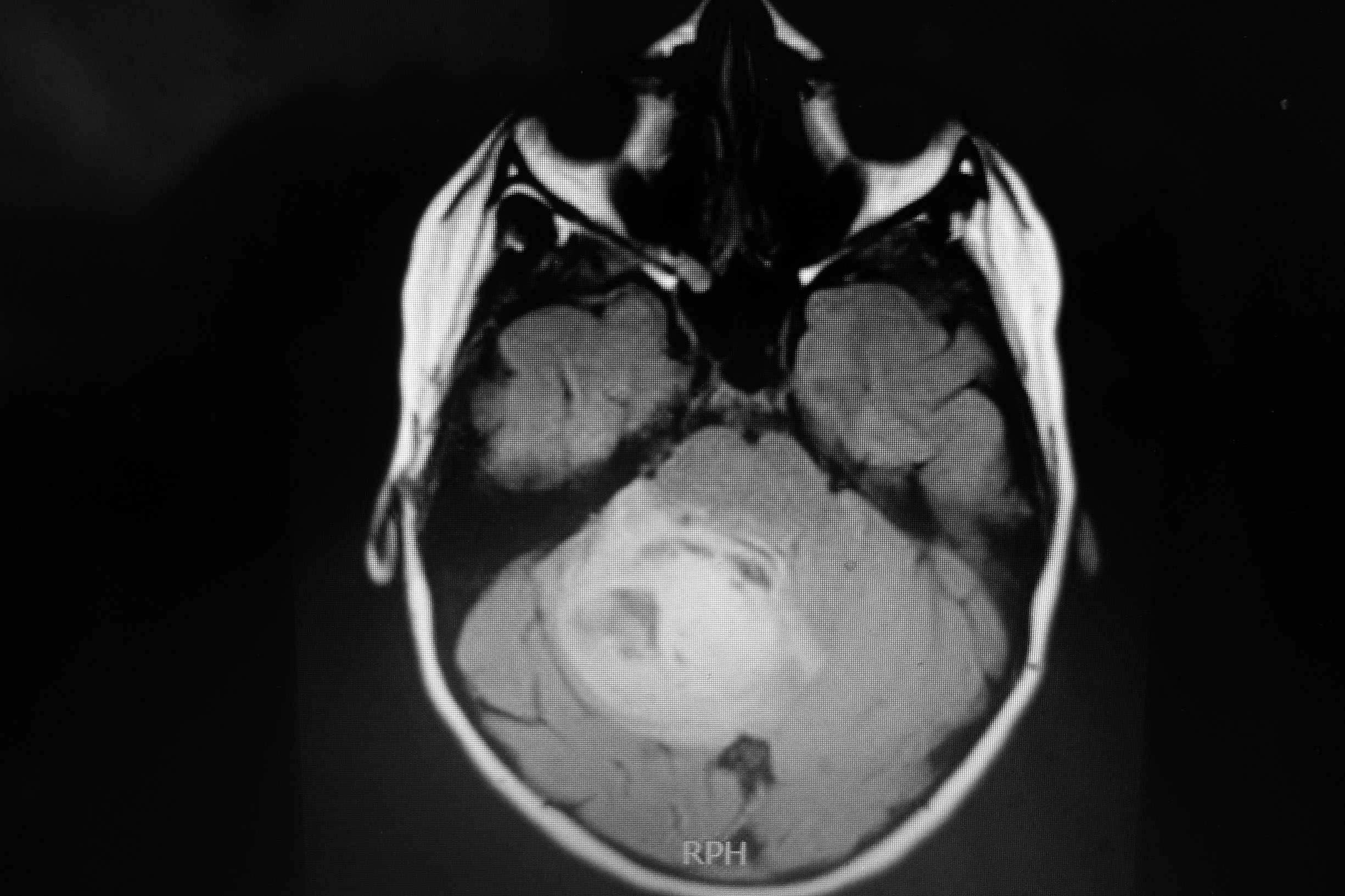 Figure 1 b