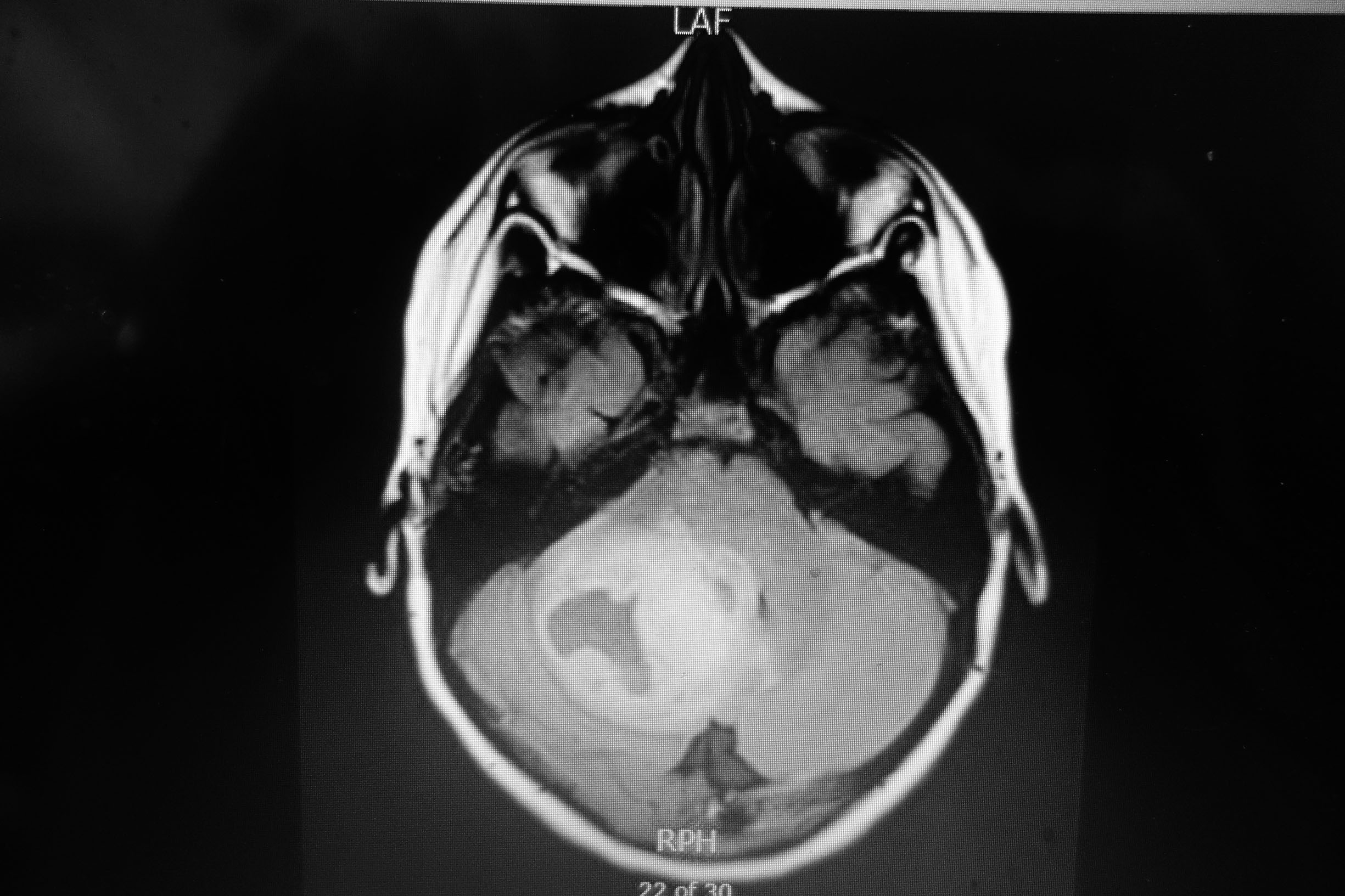 Figure 1 a