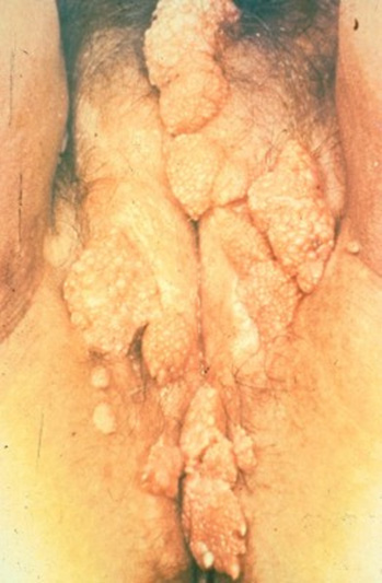 Figure 2a