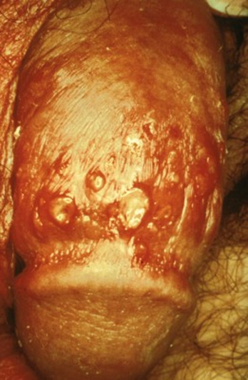 Figure 3a