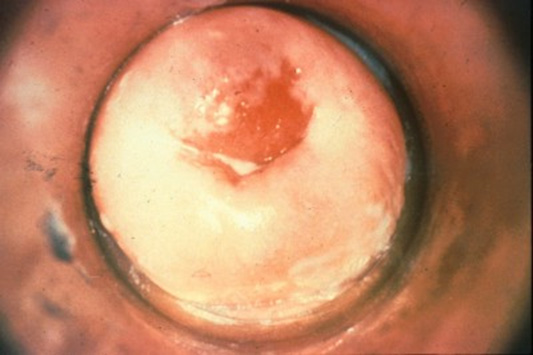 Figure 4b