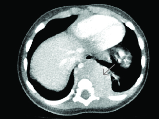 Figure 6-bottom