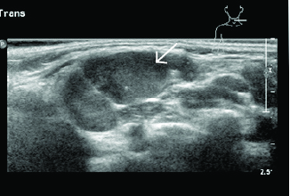 Figure 6-top