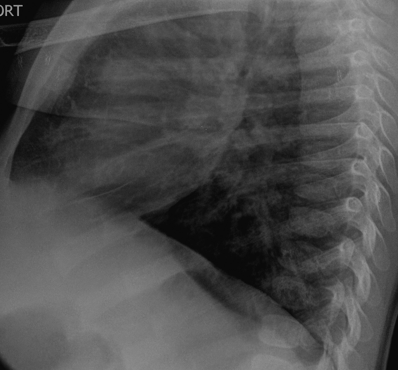 Figure 3b
