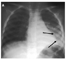 Figure 4a