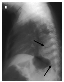 Figure 4b