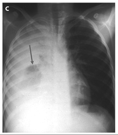 Figure 4c