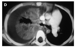 Figure 4d