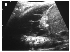 Figure 4e