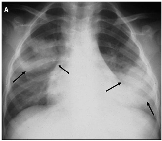 Figure 5a