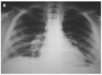 Figure 5b