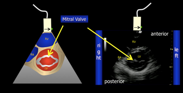 Figure 4 top